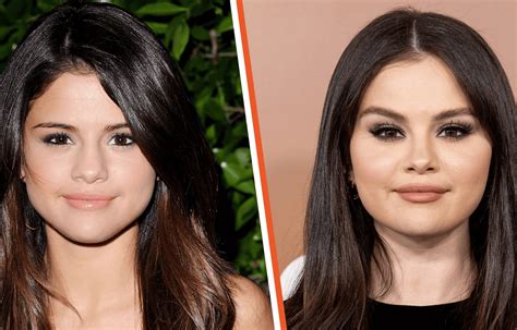 selena gomez boobs before and after|Selena Gomez All Plastic Surgery Revealed – Before。